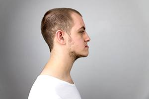 Profile view of young man with an overbite