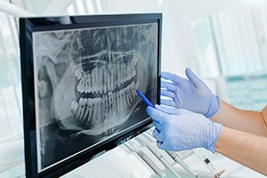 a dentist pointing at an X-ray on a monitor