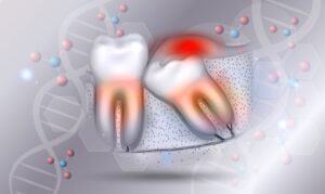 Illustration of wisdom tooth with DNA molecule in background